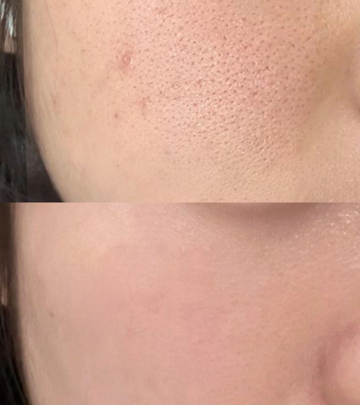 Skin Reviver