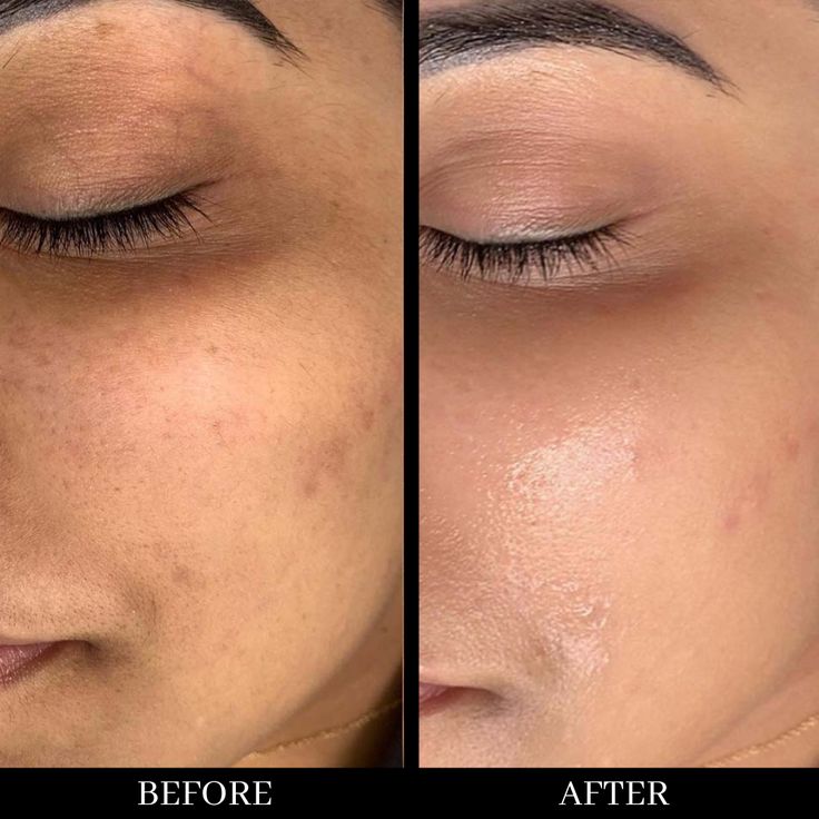 Brightening Elixir